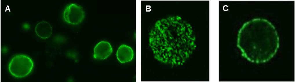 Fig. 2. Fluorescent antibody to membrane antigen (FAMA) test.
						The images were taken with an Axioscope fluorescent microscope (A) and
						an a Leica SP2 confocal microscope (B, stacking image; C, single plane image)