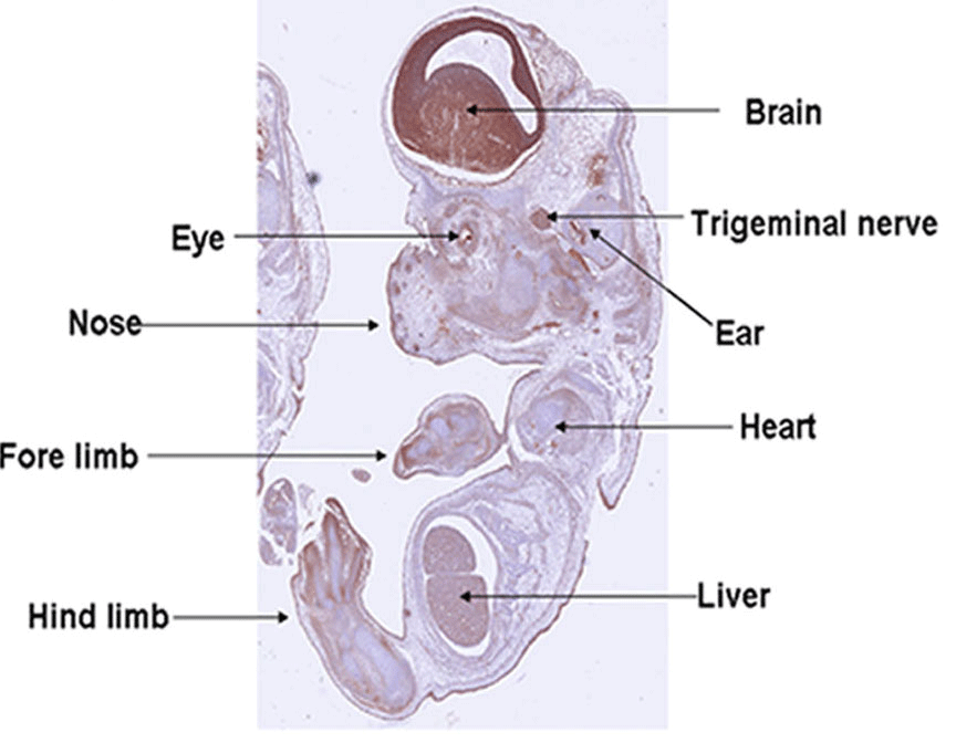 Brain, Trigeminal nerve, Ear, Heart, Liver, Eye, Nose, Fore limb, Hind limb