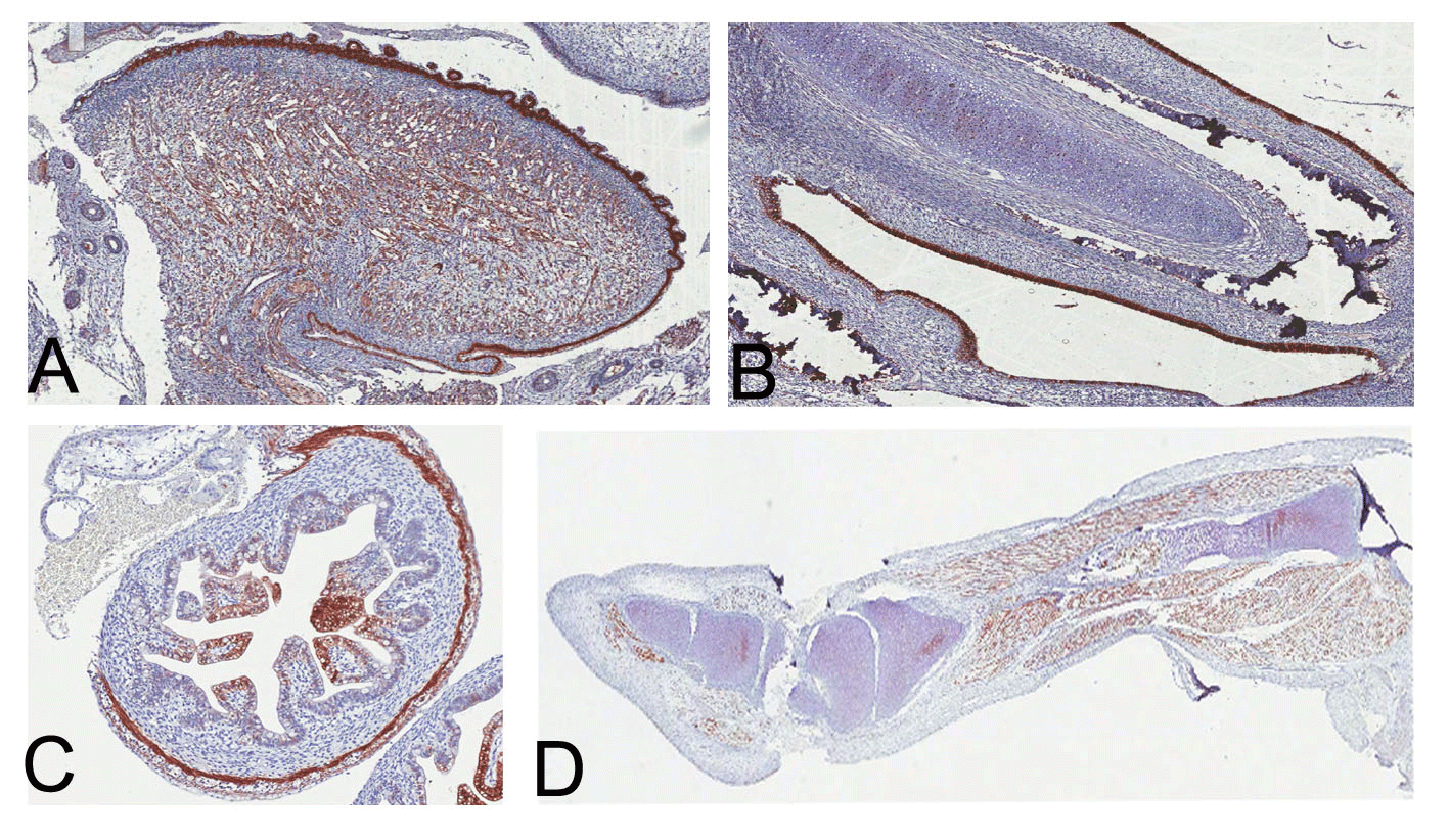 Fig. 7. The immunohistochemical analysis of the enteroviral VP1 capsid protein from tissues in an encephalocele case.