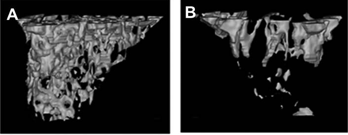 Fig. 8. MicroCT images of the tibia of mock (A) and
									CVB3-infected (B) mice at 28 dpi